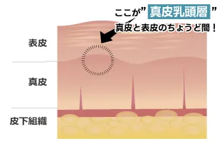表皮と真皮の境にある真皮乳頭層の位置を示した図