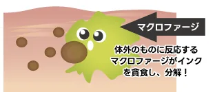 マクロファージがインクを貪食・分解するしくみの図